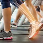 a woman with an ankle injury on a treadmill