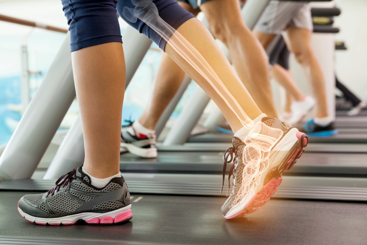 a woman with an ankle injury on a treadmill 